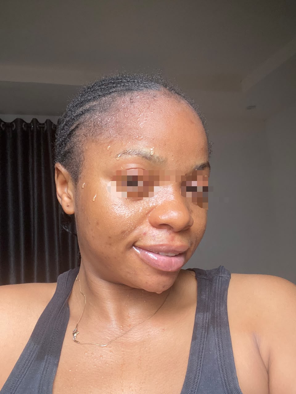 Skin after using Mosidrol